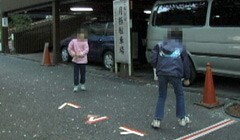 #2 顔面陥没